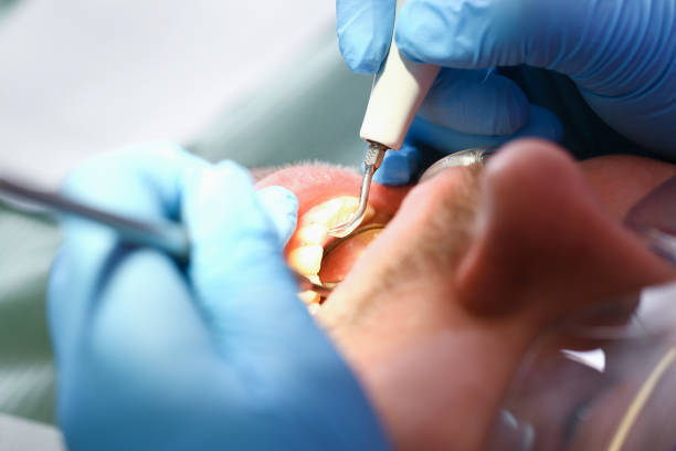 Best Pediatric Emergency Dentist in Mino Tassajara, CA