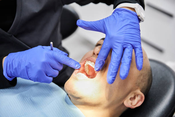 Best Broken or Cracked Tooth Emergency Dentist in Mino Tassajara, CA